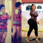 moesha boduong before surgery