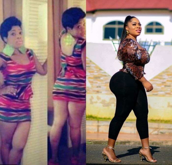 moesha boduong before surgery